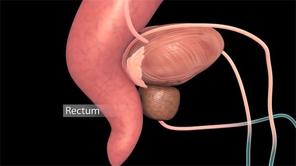 三維動畫制作35 三維動畫制作35