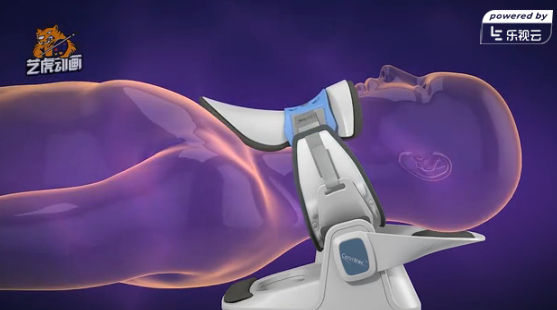 醫學三維動畫制作 醫學三維動畫制作