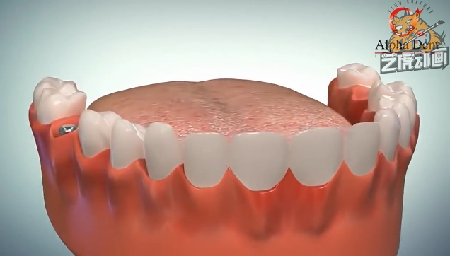 醫療三維動畫 醫療三維動畫