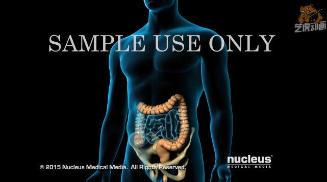 醫(yī)療三維動(dòng)畫(huà)